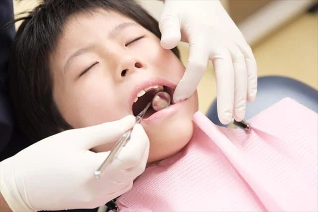 歯科におけるルートサンプリング